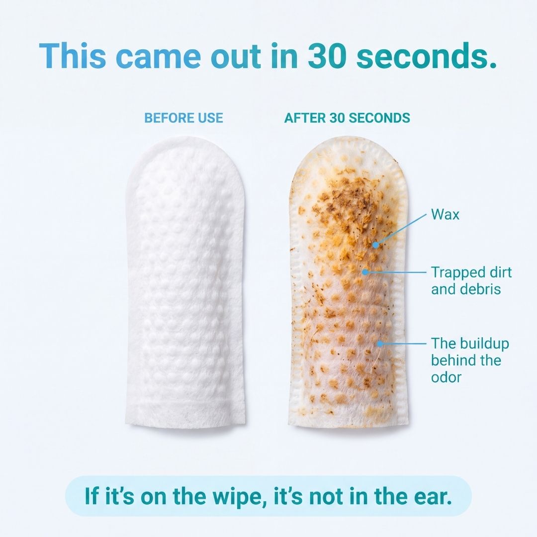 EarWipes Kit - Beskytter Mot Oreproblemer