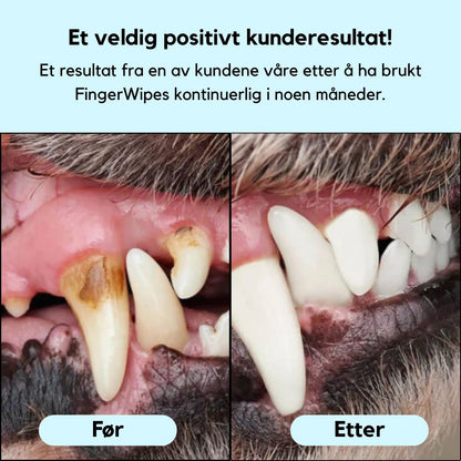FreshWipe Kit - Beskytter mot tannproblemer